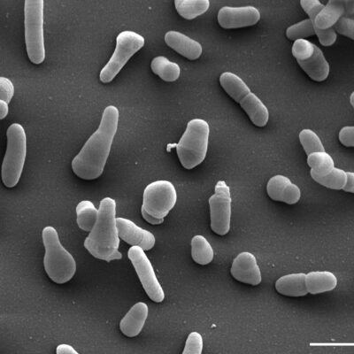 Denitrifikujuće bakterije